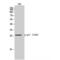 Cyclin Dependent Kinase Inhibitor 1B antibody, LS-C380973, Lifespan Biosciences, Western Blot image 