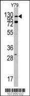 ABL Proto-Oncogene 1, Non-Receptor Tyrosine Kinase antibody, 63-153, ProSci, Western Blot image 