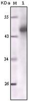 Keratin 5 antibody, 32-143, ProSci, Enzyme Linked Immunosorbent Assay image 