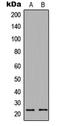 PTTG1 Interacting Protein antibody, GTX55274, GeneTex, Western Blot image 