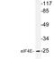 Eukaryotic Translation Initiation Factor 4E antibody, LS-C177501, Lifespan Biosciences, Western Blot image 