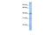 Thioredoxin Domain Containing 15 antibody, GTX45978, GeneTex, Western Blot image 