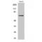 LIM Domain Kinase 2 antibody, LS-C384348, Lifespan Biosciences, Western Blot image 