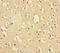 DEAH-Box Helicase 35 antibody, LS-C397975, Lifespan Biosciences, Immunohistochemistry paraffin image 