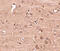 GLE1 RNA Export Mediator antibody, 4963, ProSci, Immunohistochemistry paraffin image 