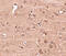 Nucleoporin GLE1 antibody, 4963, ProSci, Immunohistochemistry paraffin image 