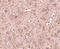 Ceramide Synthase 6 antibody, A07033, Boster Biological Technology, Immunohistochemistry paraffin image 