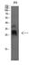TIMP Metallopeptidase Inhibitor 4 antibody, STJ98630, St John