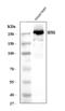 Myosin Heavy Chain 6 antibody, A02808-2, Boster Biological Technology, Western Blot image 