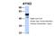 Septin 11 antibody, NBP1-58144, Novus Biologicals, Western Blot image 