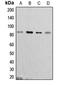 Cortactin antibody, LS-C353339, Lifespan Biosciences, Western Blot image 