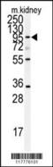 ADAM Metallopeptidase Domain 9 antibody, 62-909, ProSci, Western Blot image 