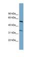 Threonine Synthase Like 2 antibody, orb326156, Biorbyt, Western Blot image 