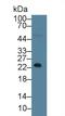 NPHS1 Adhesion Molecule, Nephrin antibody, LS-C663127, Lifespan Biosciences, Western Blot image 