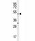 Myocyte Enhancer Factor 2D antibody, F41643-0.4ML, NSJ Bioreagents, Western Blot image 