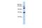 EF-Hand Calcium Binding Domain 13 antibody, GTX45670, GeneTex, Western Blot image 