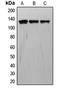 Tyrosine Kinase With Immunoglobulin Like And EGF Like Domains 1 antibody, LS-C352933, Lifespan Biosciences, Western Blot image 