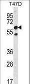 CTD Small Phosphatase 2 antibody, LS-C162902, Lifespan Biosciences, Western Blot image 