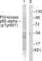 Phosphoinositide-3-Kinase Regulatory Subunit 1 antibody, LS-C199438, Lifespan Biosciences, Western Blot image 