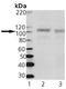 Discs Large MAGUK Scaffold Protein 3 antibody, ADI-VAM-PS006-F, Enzo Life Sciences, Western Blot image 