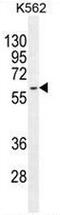 Keratin 73 antibody, AP52420PU-N, Origene, Western Blot image 