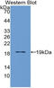 Interleukin 3 Receptor Subunit Alpha antibody, LS-C294900, Lifespan Biosciences, Western Blot image 