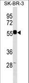 Endonuclease/Exonuclease/Phosphatase Family Domain Containing 1 antibody, LS-C159508, Lifespan Biosciences, Western Blot image 