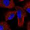 Protein Kinase CAMP-Dependent Type II Regulatory Subunit Alpha antibody, HPA038268, Atlas Antibodies, Immunofluorescence image 