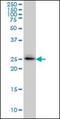 SplA/Ryanodine Receptor Domain And SOCS Box Containing 2 antibody, orb89802, Biorbyt, Western Blot image 