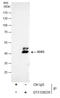 Transcription factor SOX-3 antibody, GTX129235, GeneTex, Immunoprecipitation image 