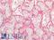 Keratin 5 antibody, LS-A11429, Lifespan Biosciences, Immunohistochemistry paraffin image 
