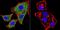 Catenin Alpha 1 antibody, GTX17259, GeneTex, Immunofluorescence image 