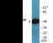 SMAD Family Member 3 antibody, EKC2277, Boster Biological Technology, Western Blot image 