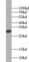 Tetraspanin 6 antibody, FNab09065, FineTest, Western Blot image 