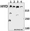 Ubiquitin Protein Ligase E3 Component N-Recognin 5 antibody, A03160T14, Boster Biological Technology, Western Blot image 