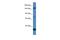 Eukaryotic Translation Initiation Factor 5B antibody, A04604, Boster Biological Technology, Western Blot image 