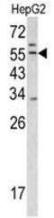 Transmembrane protease serine 2 antibody, GTX81494, GeneTex, Western Blot image 