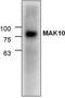 N(Alpha)-Acetyltransferase 35, NatC Auxiliary Subunit antibody, TA318872, Origene, Western Blot image 