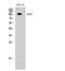 EPH Receptor A7 antibody, STJ92946, St John