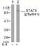 Signal Transducer And Activator Of Transcription 6 antibody, TA309960, Origene, Western Blot image 
