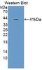 Glycosylphosphatidylinositol Specific Phospholipase D1 antibody, abx129033, Abbexa, Western Blot image 