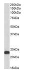 Biliverdin Reductase B antibody, orb178386, Biorbyt, Western Blot image 