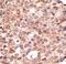 Cryptochrome Circadian Regulator 2 antibody, LS-C100383, Lifespan Biosciences, Immunohistochemistry paraffin image 