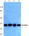 ADP/ATP translocase 3 antibody, A09457-1, Boster Biological Technology, Western Blot image 
