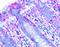 MLX Interacting Protein Like antibody, NB400-135B, Novus Biologicals, Immunohistochemistry frozen image 