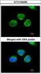 Aflatoxin B1 aldehyde reductase member 2 antibody, LS-C185612, Lifespan Biosciences, Immunocytochemistry image 