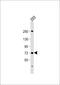 Solute Carrier Family 6 Member 19 antibody, 61-282, ProSci, Western Blot image 