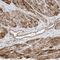 Ankyrin repeat and zinc finger domain-containing protein 1 antibody, PA5-57197, Invitrogen Antibodies, Immunohistochemistry paraffin image 