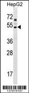 AADACL2 antibody, 59-156, ProSci, Western Blot image 