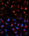 Keratin 18 antibody, 13-511, ProSci, Immunofluorescence image 